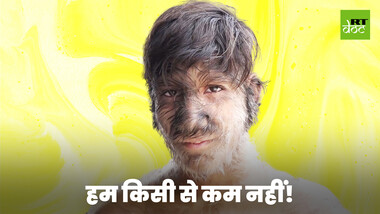 खास होना कैसा लगता है?