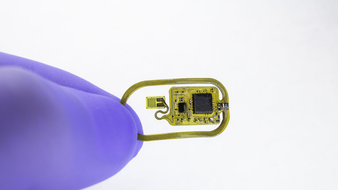 Компанија Илона Маска уградила први чип у људски мозак