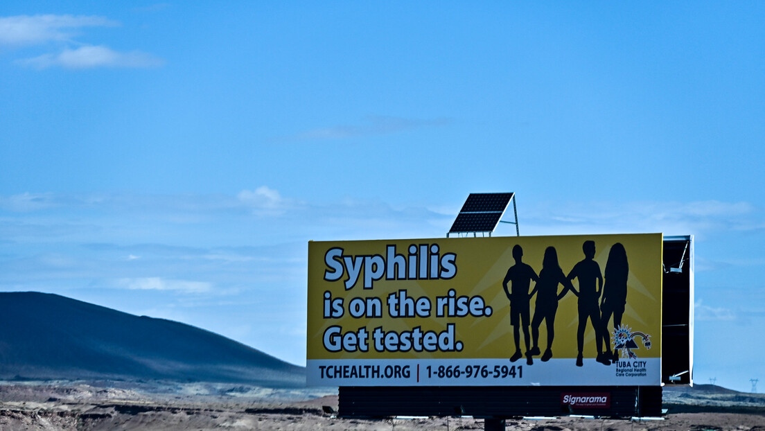 Novi američki rekord: Broj osoba sa sifilisom na najvišem nivou u poslednjih 70 godina