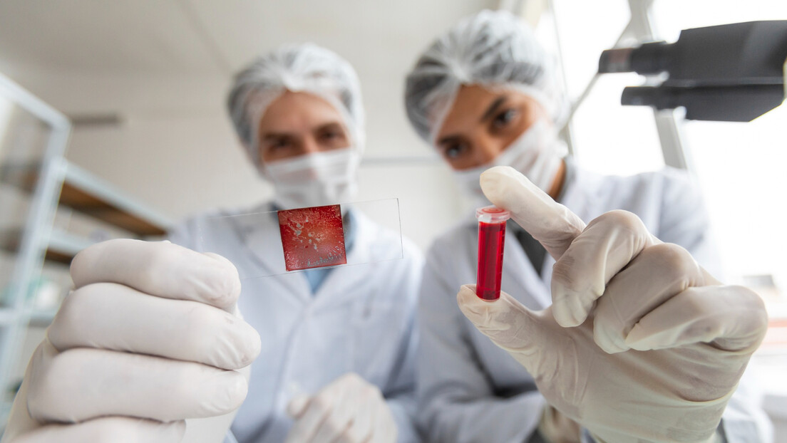 Test krvi uz korišćenje veštačke inteligencije novi metod u dijagnostici sepse