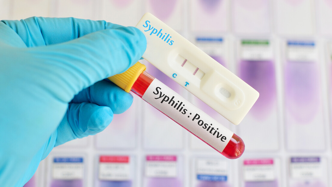 Стара болест прогони модерну Америку: Добра вест је да је "излечивa", лоша - у питању је сифилис