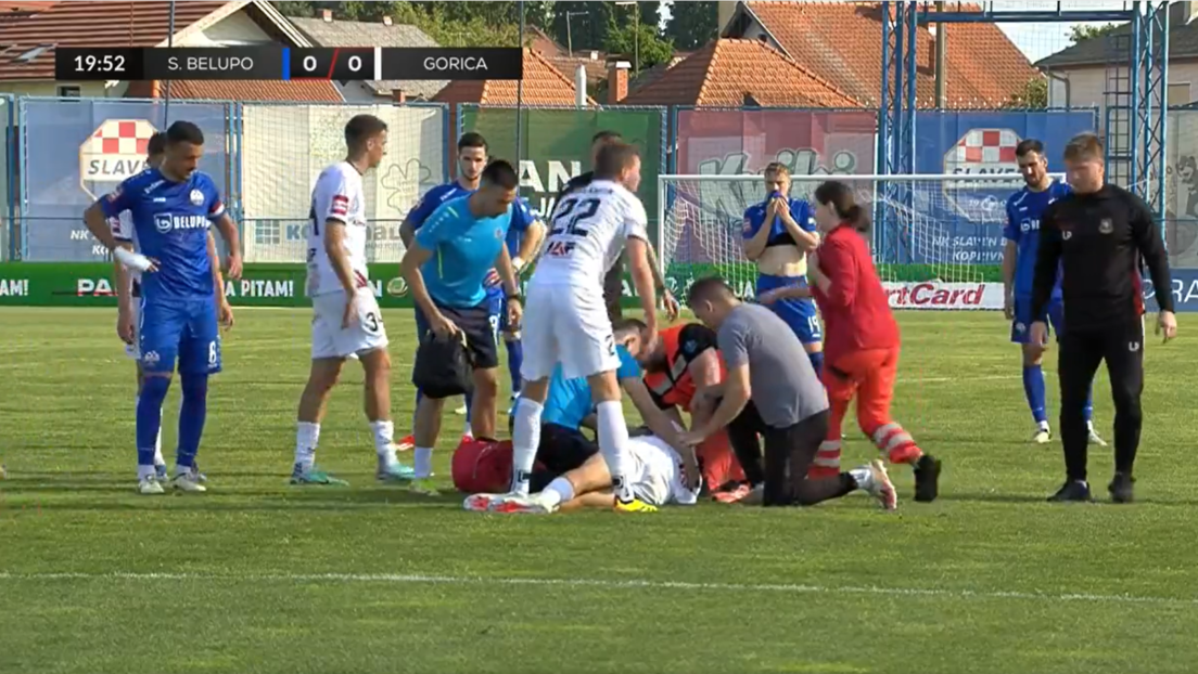 Језива повреда Србина у Хрватској - добио ударац коленом у главу и два прелома лица