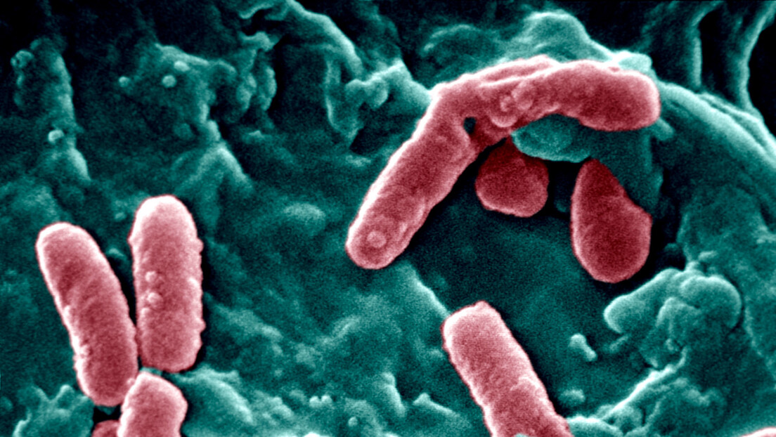 У САД проглашена епидемија листериозе: Две особе умрле, 28 заражено