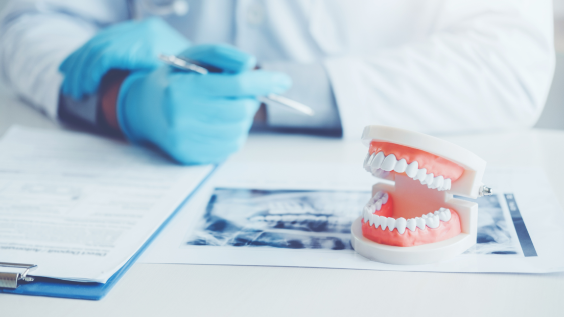 Iznenađujući simptomi menopauze koje prvo primeti vaš stomatolog