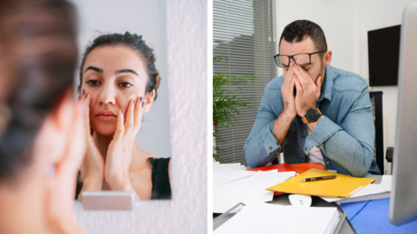 Сува кожа, поспаност, глад: Ово су знаци да вам недостају масти у исхрани