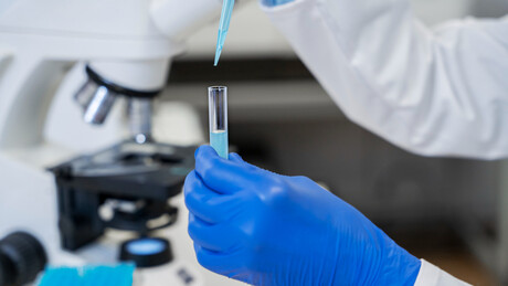 Život iz ogledala: Obrnute ćelije sve više zabrinjavaju naučnike