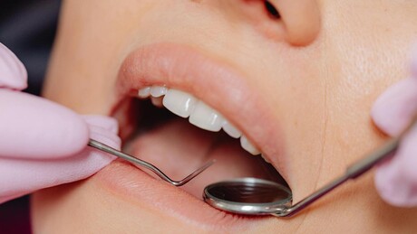 Gubitak zuba može biti rani znak smrtonosnog rizika, ukazuje studija