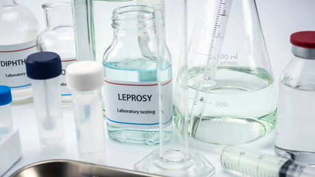 Случајеви губе потврђени у Хрватској и Румунији