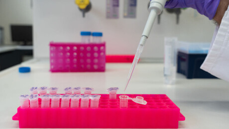 Да ли се лепра појавила у Србији и како се лечи