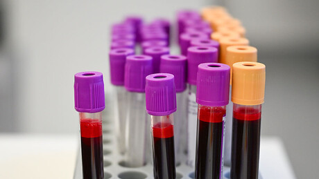 Босна и Херцеговина: Олово у крви пронађено код више од 300 грађана Вареша