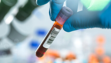 Svetski dan borbe protiv hematoloških maligniteta: Savremeni lekovi spašavaju živote