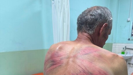 Зубин Поток: Албански полицајци се иживљавали над Србином, тражили да призна "ратни злочин"