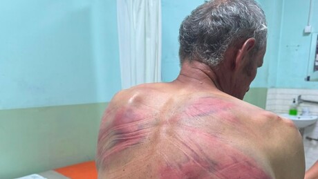 Претучени Србин са КиМ на путу за Београд: Лечење наставља на КЦС
